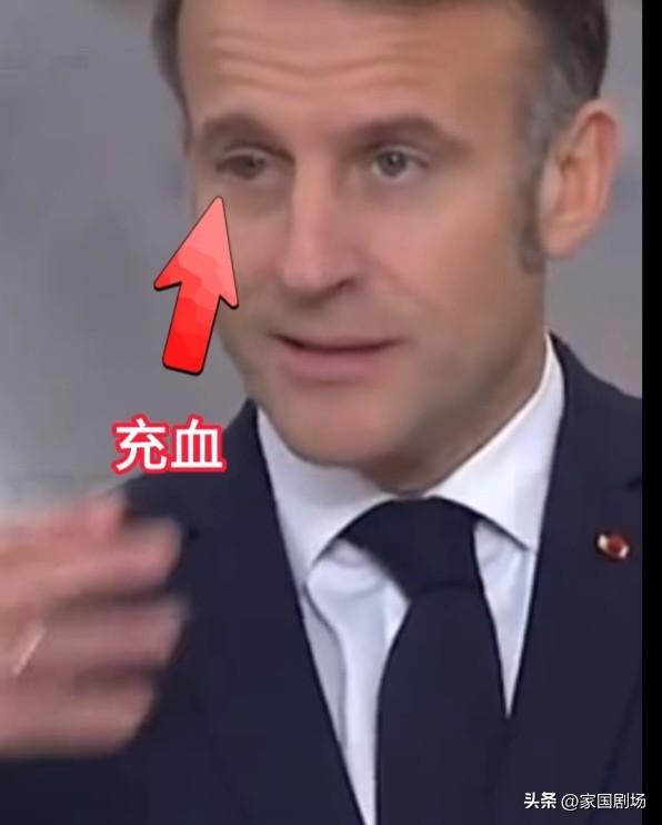 马克龙参加活动眼睛通红充血，疑似被打过。
       “请原谅我眼睛难看的样子