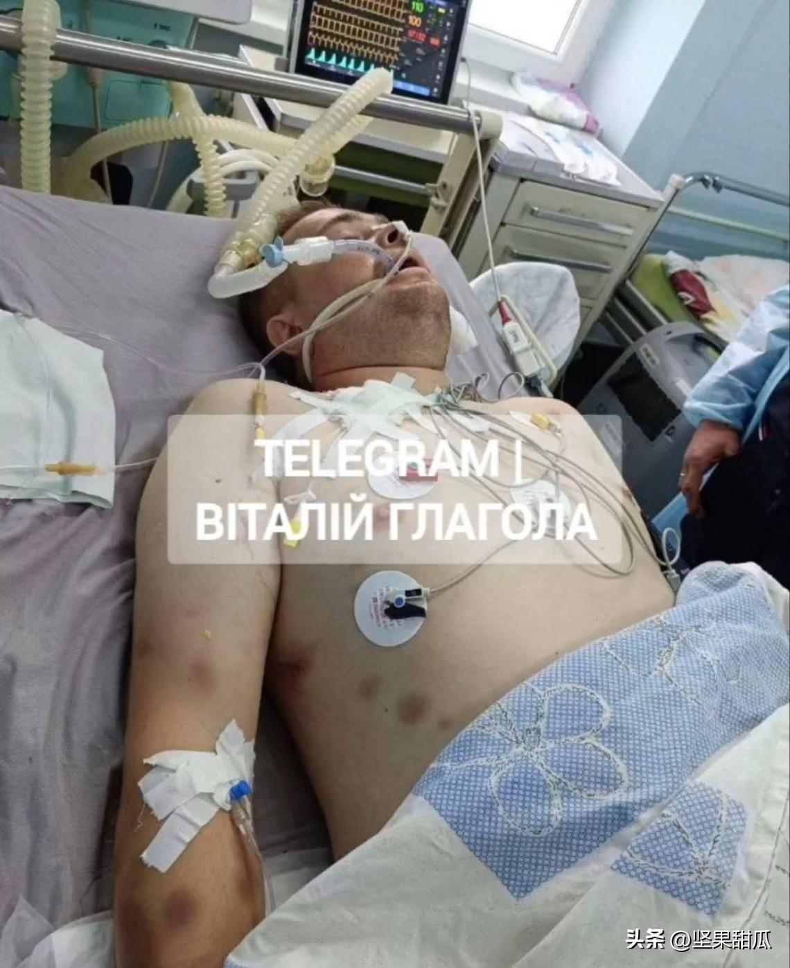 乌克兰扎喀尔巴阡州的征兵办，一名29岁男子
第一次在医院检查后，他被允许出院，但