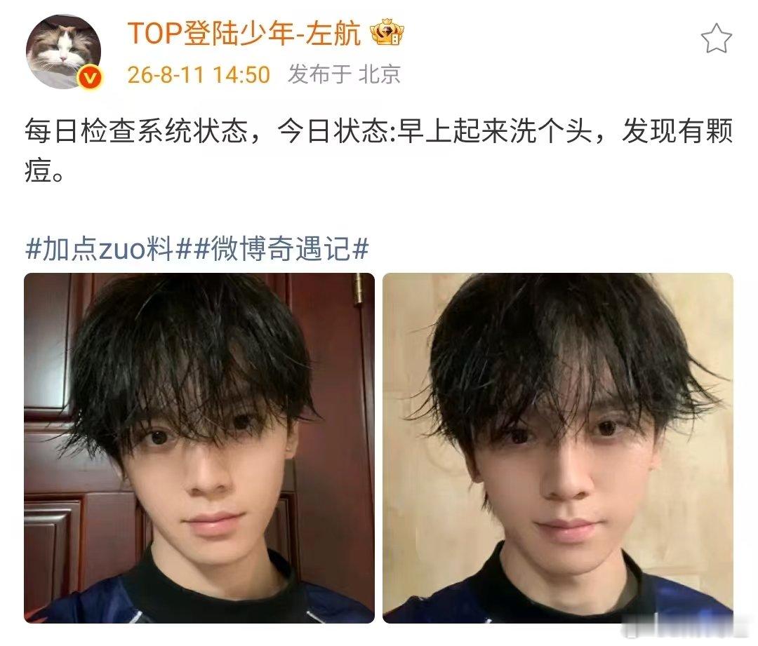 左航长痘了左航嘴角长了痘左航今天长痘了 