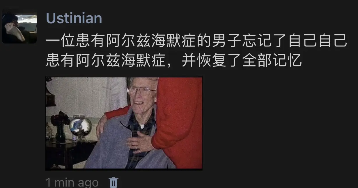 阿尔兹海默症 内容过于真实