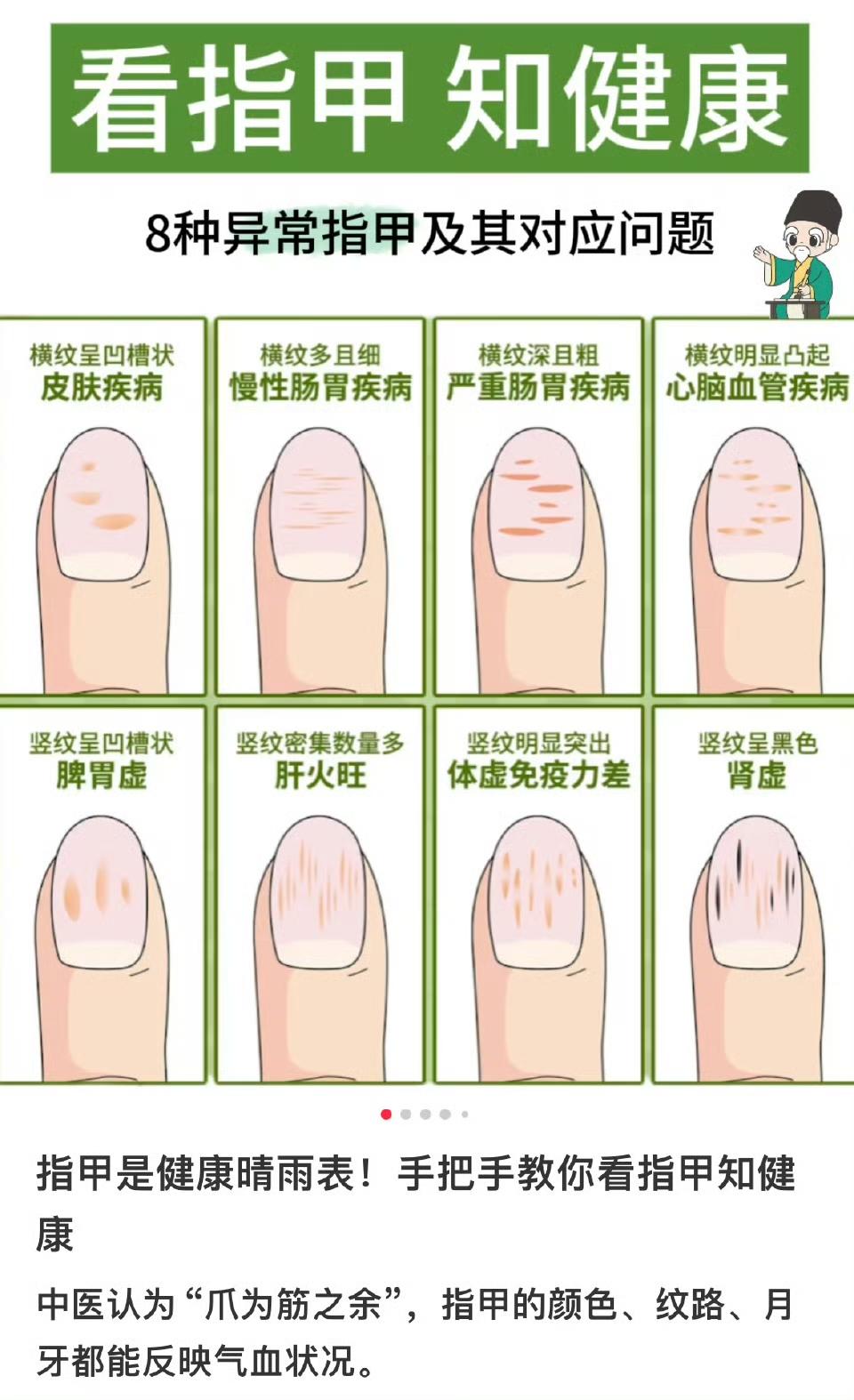 你平时会注意自己的指甲吗？最近，“看指甲辨健康”这个话题在网上可火了，不少人都在
