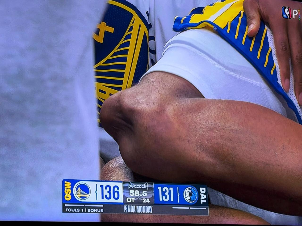 希望只是关节脱位吧，但是即使这样也是赛季报销了，就算是最好的情况也得伤缺3-6个