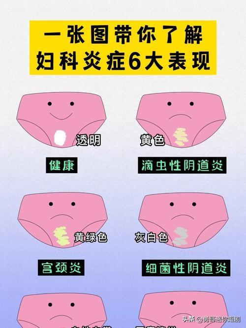 没有夫妻生活会不会得妇科病?这是一个非常普遍的误区：没有性生活 ≠ 不会得妇科病