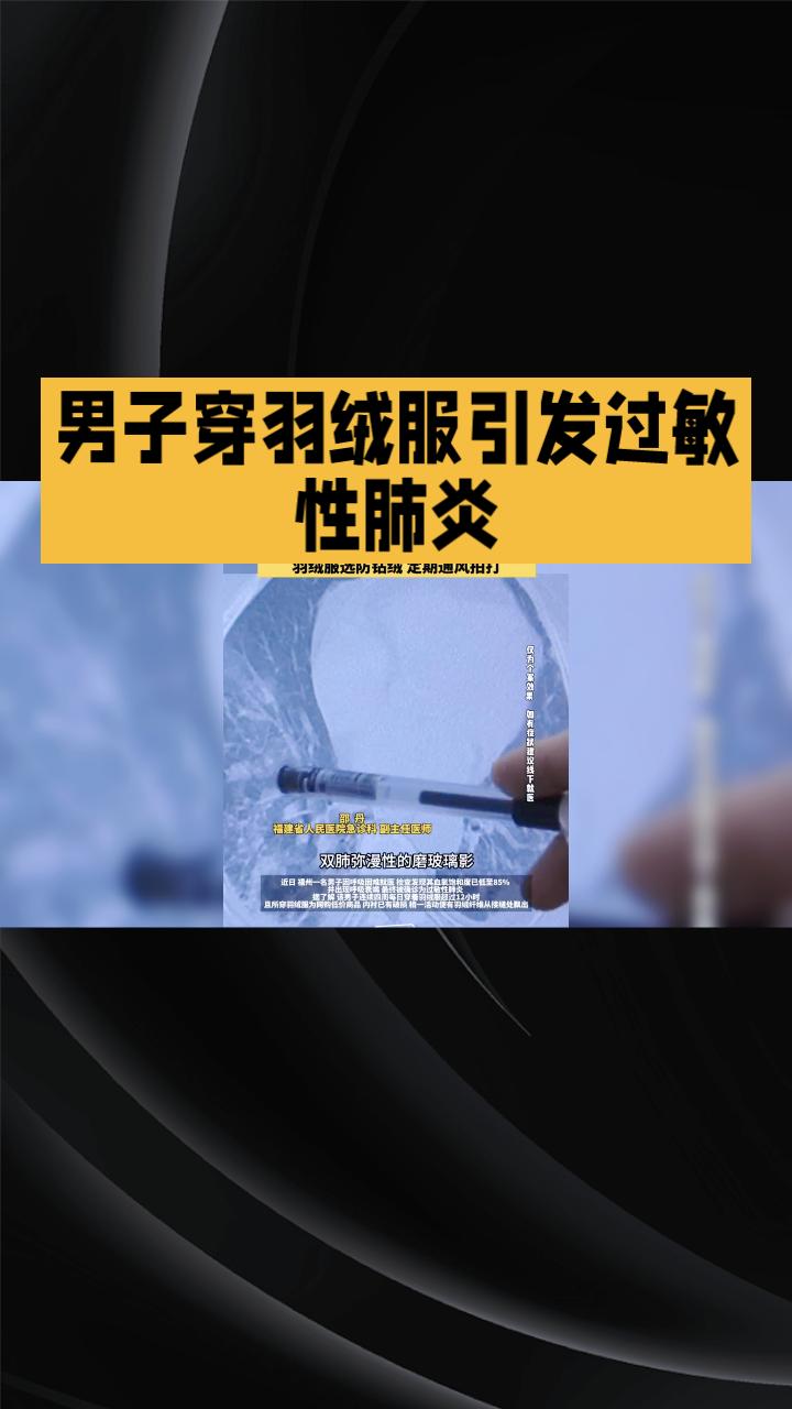 穿羽绒服真的会导致肺部受损吗？这听起来像是个玩笑，但确有其事！
近日，福建一名男