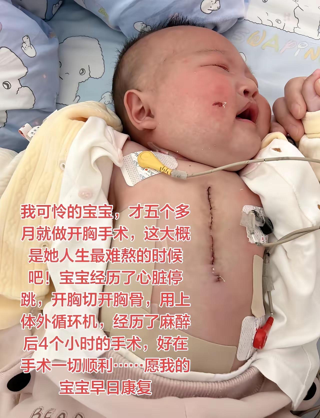 愿天下所有宝宝健康成长……
5个月的宝宝，
开膛破肚，
先天性心脏病……
孩子是