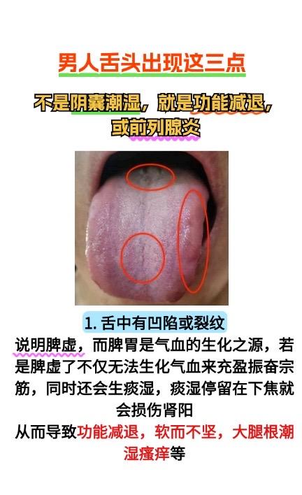 男人舌头出现这三点，一定要重视##医学科普 #舌苔辨证 #中医