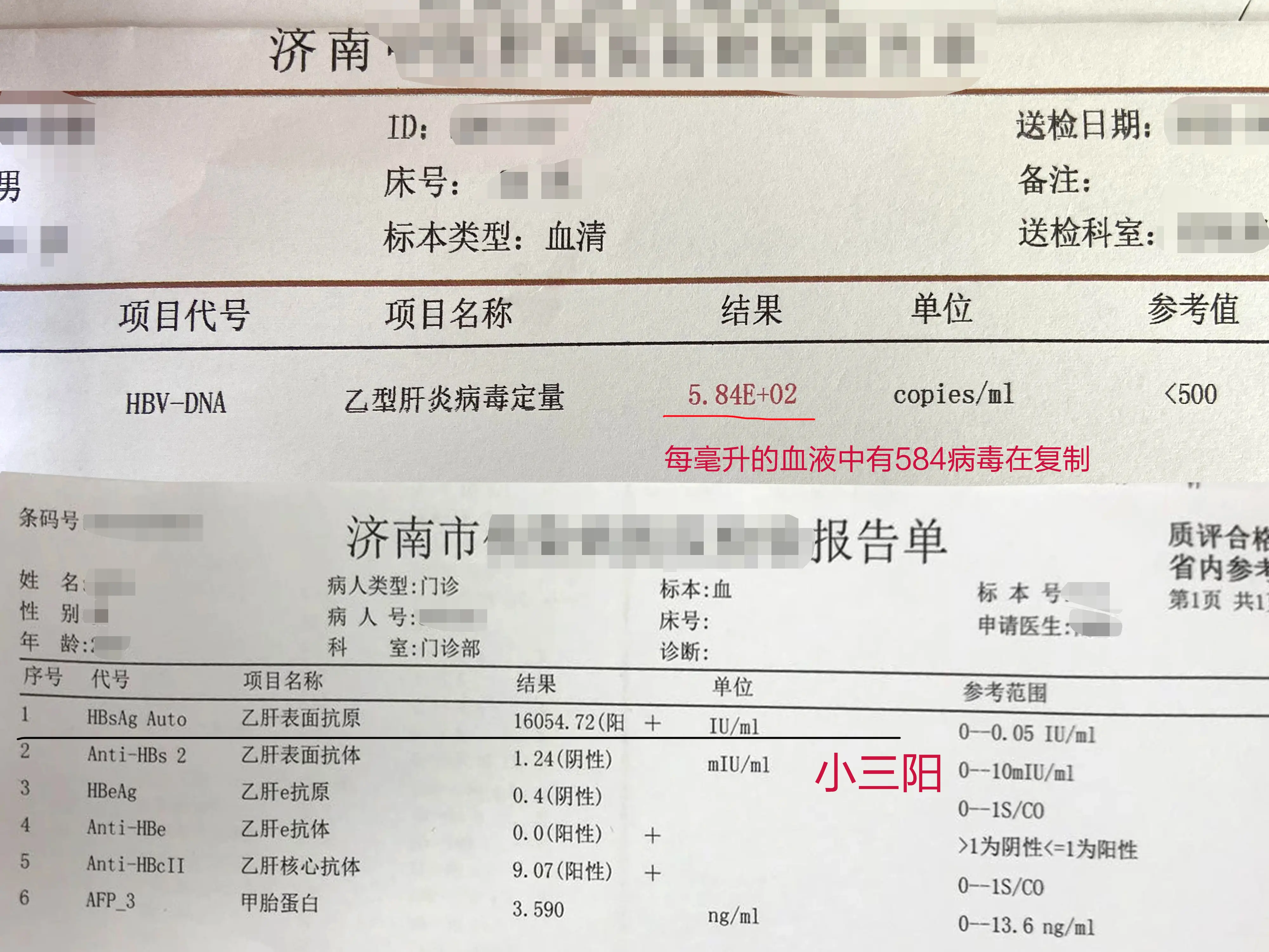 怎样判断乙肝严不严重？这②点是关键  ①乙肝五项和病毒量：通过乙肝五项...