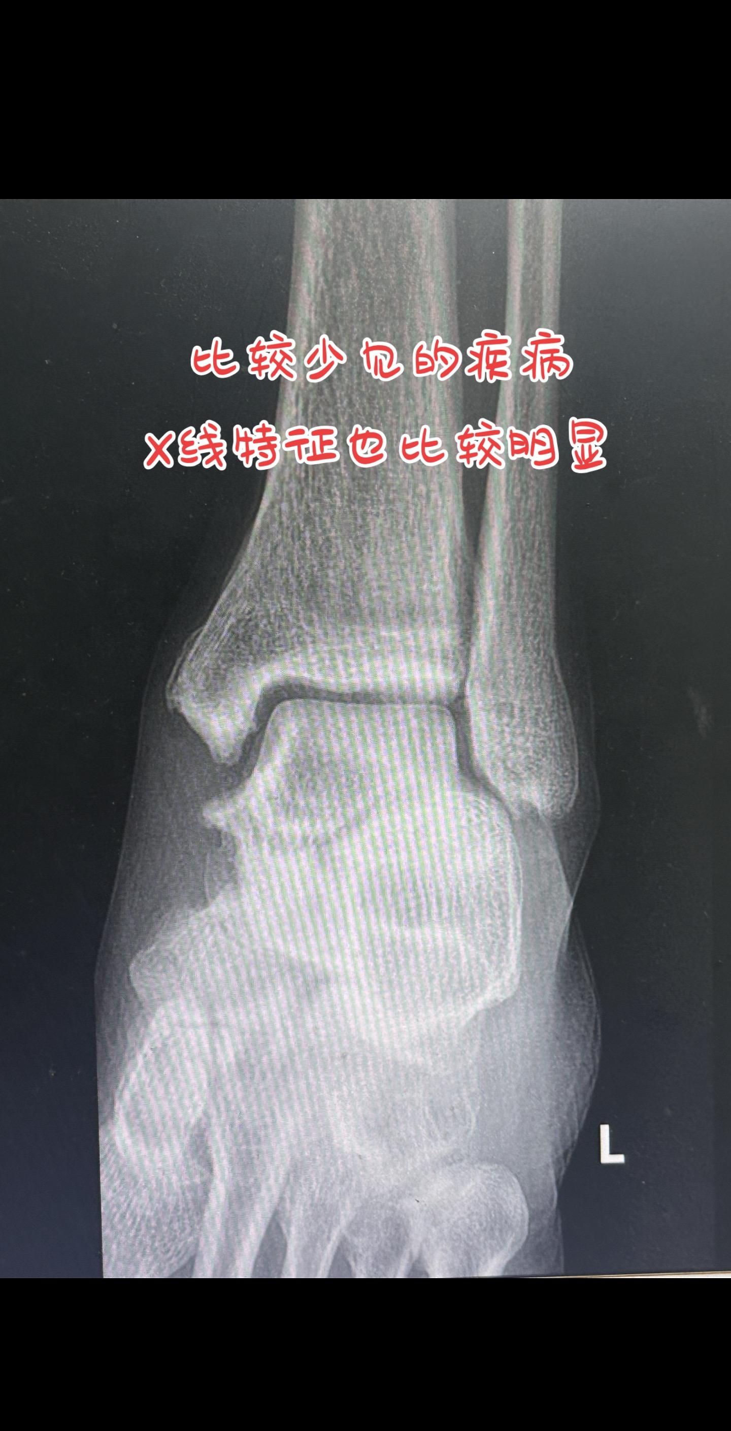 大家一起来找茬。案例分享