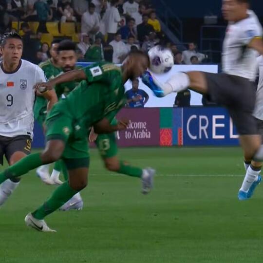 沙特被爆头球员伤口已缝合，无缘客战日本