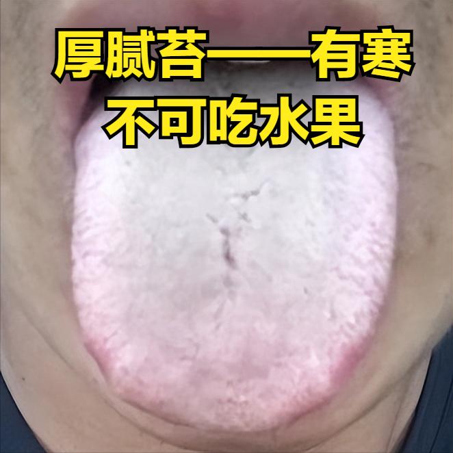中医：舌苔厚者，千万不要吃水果，齿痕重者，就不要再喝牛奶！
 
1. 舌苔厚——