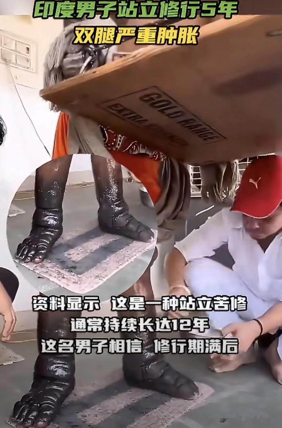 这算不算对神明的一种道德绑架？
印度一苦行僧坚持站立5年，不坐也不躺，这也导致因