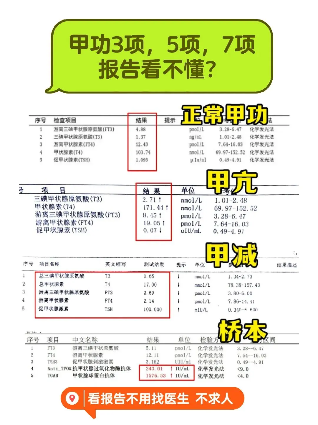 1张图看懂甲功5项报告，不求人 甲减指标: TSH升高，而FT3、FT...