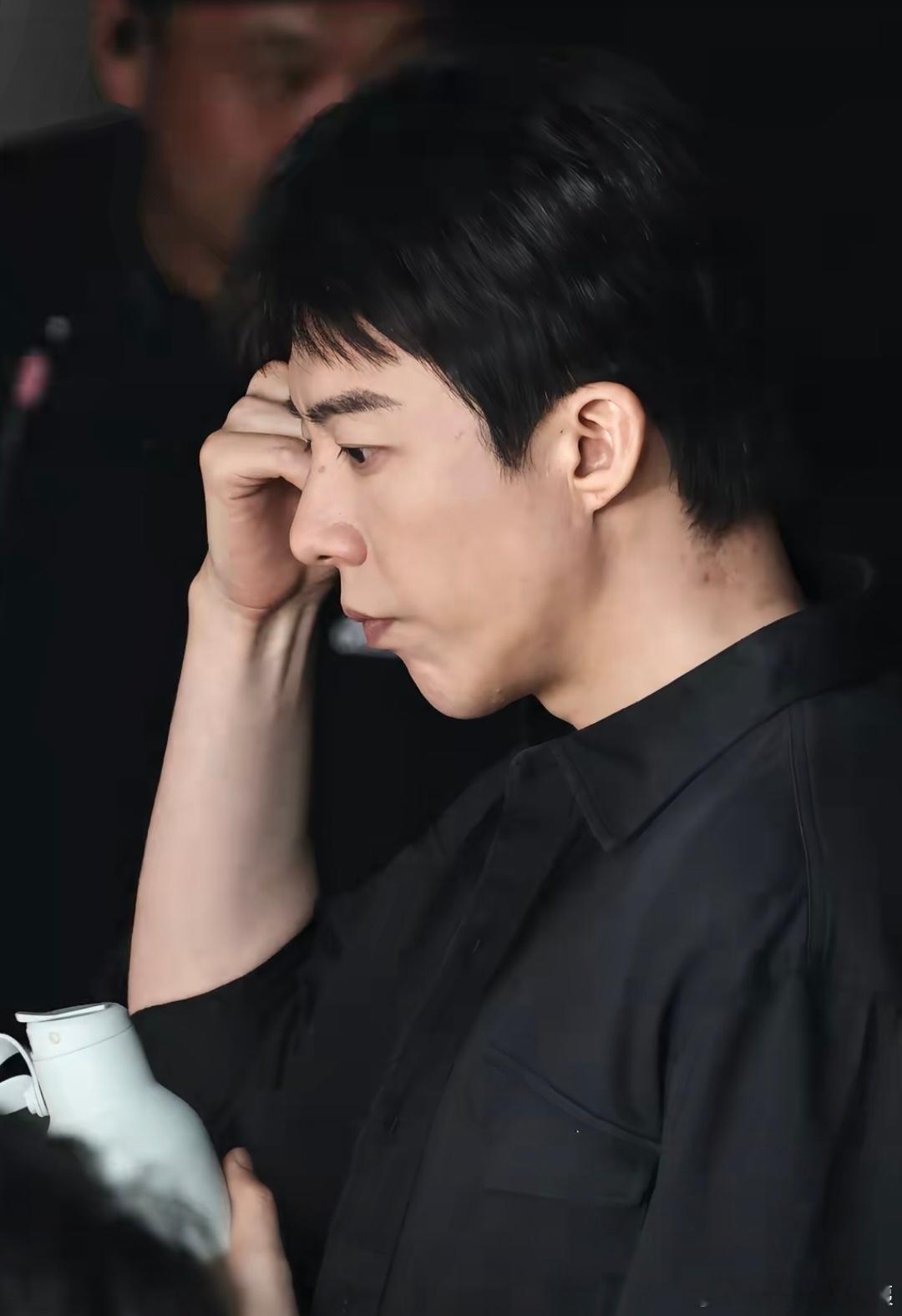以前拍古装粘头套过敏留下的痕迹好明显啊~ ​​​
