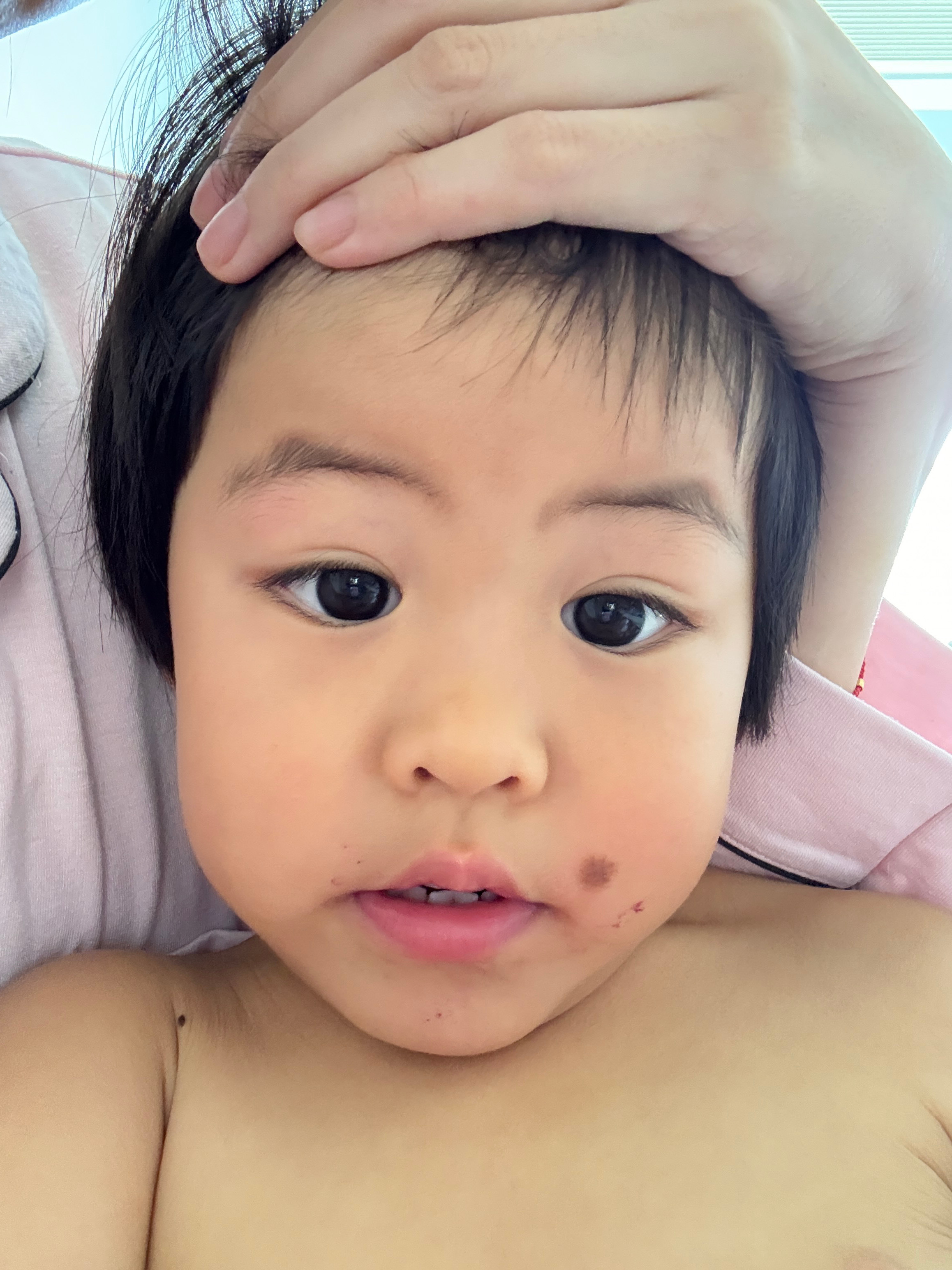 跑步太快刹不住车，撞到了架子，眼睛肿了我让她从前置镜头里看看肿包，她指着咖啡斑问