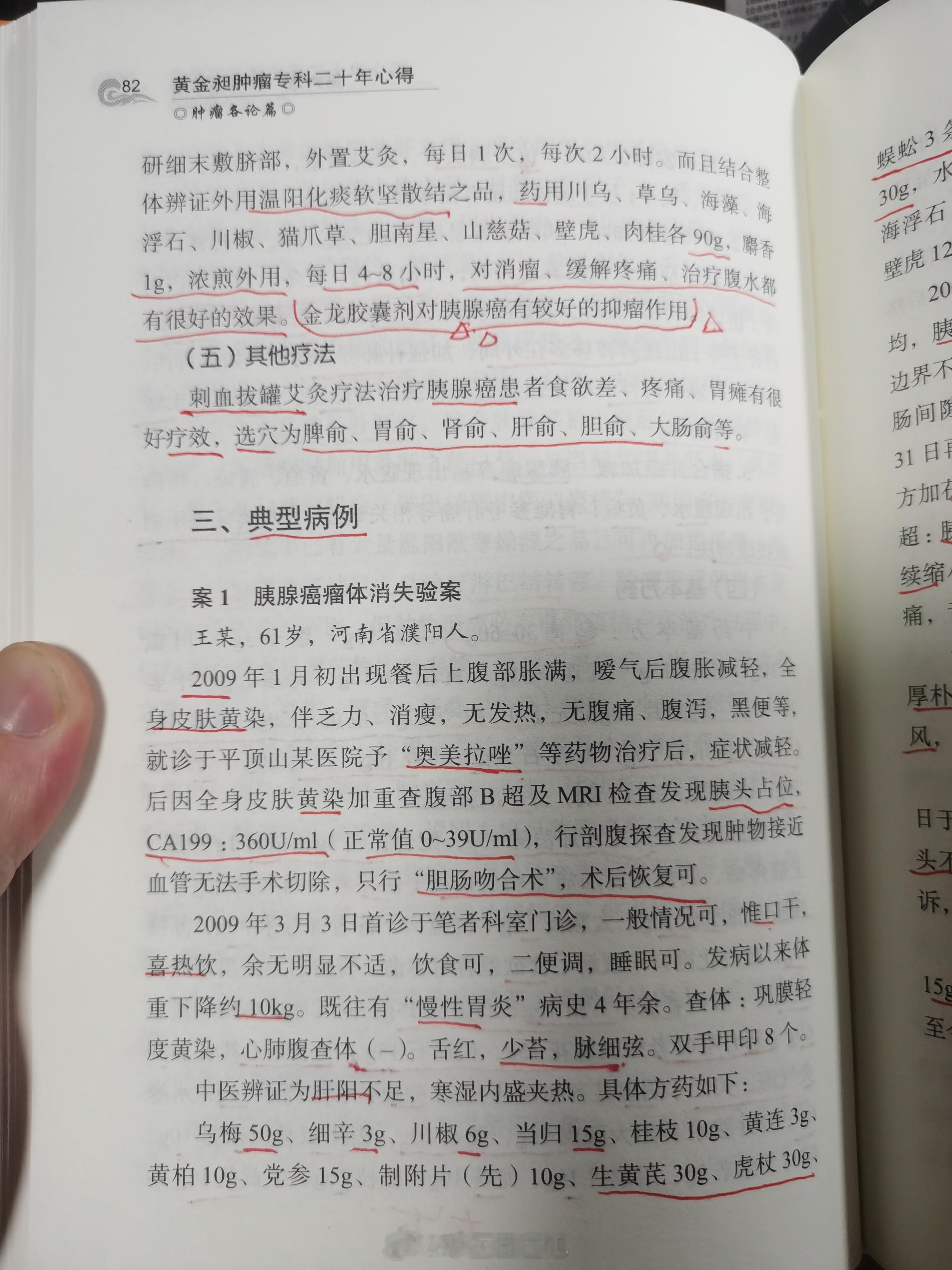 #中医##胰腺癌# 胰腺癌治到瘤体消失，肿瘤标志物完全正常，2009年到2012