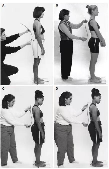 骨盆矫正 骨盆前移、前倾、后倾分不清？大家来看下面这张图，abcd 你能分辨出骨