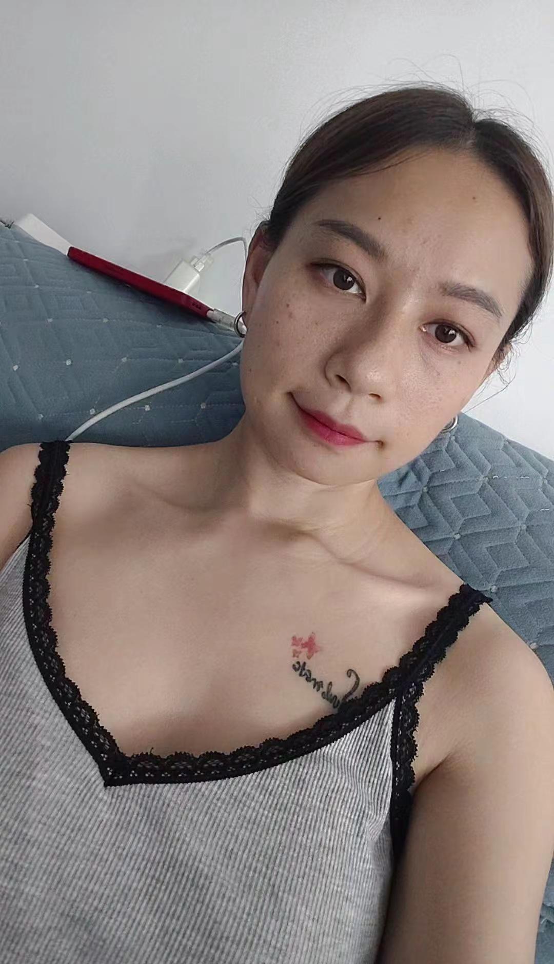 原相机拍摄，今年夏天这些天疯狂爆痘疙瘩好痒喔三十岁女人的现状 只能远观不能细看 