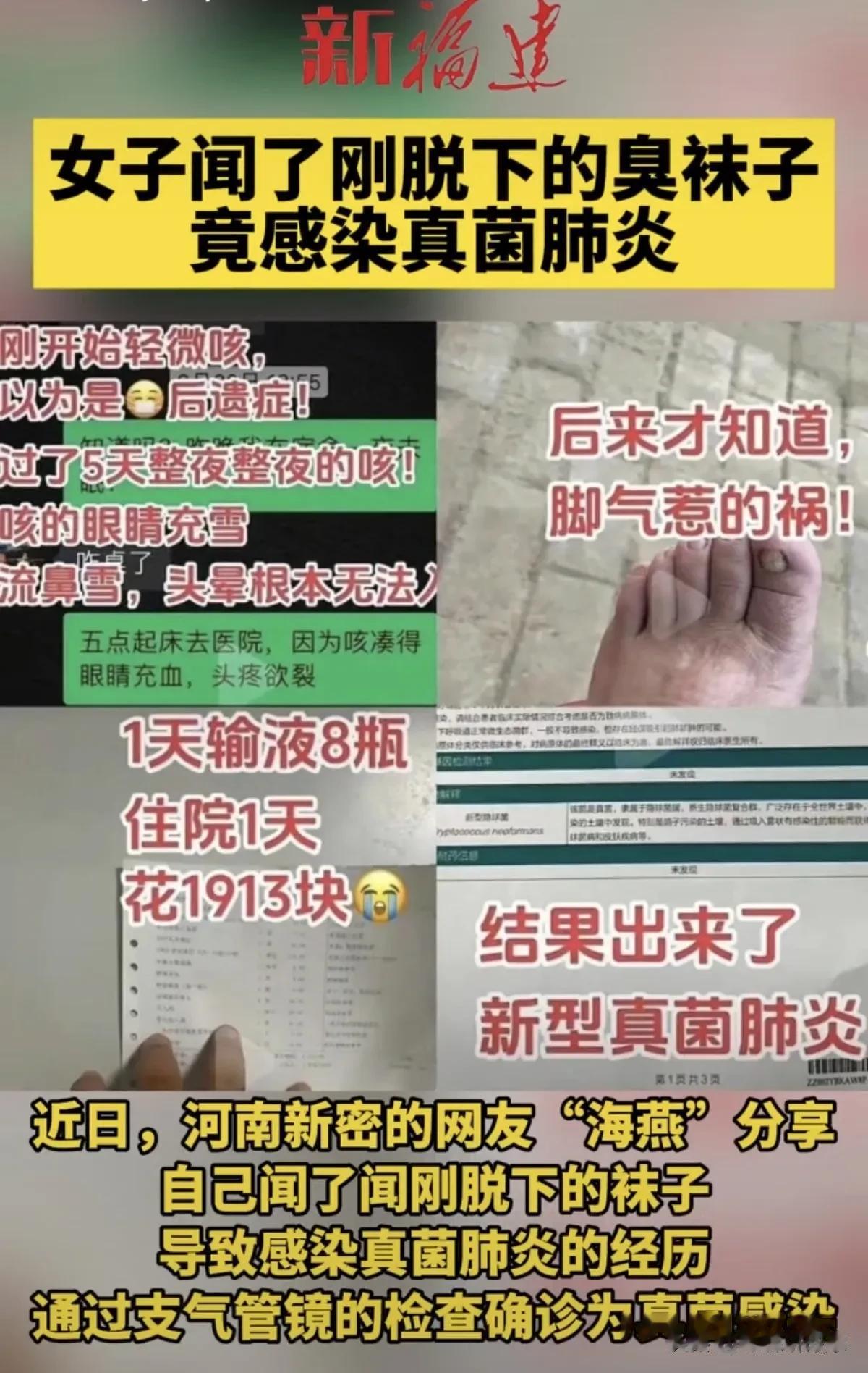 万万没想到，女子海燕因为闻了闻臭袜子，导致肺部感染真菌，咳到眼睛都痛，无法入睡，