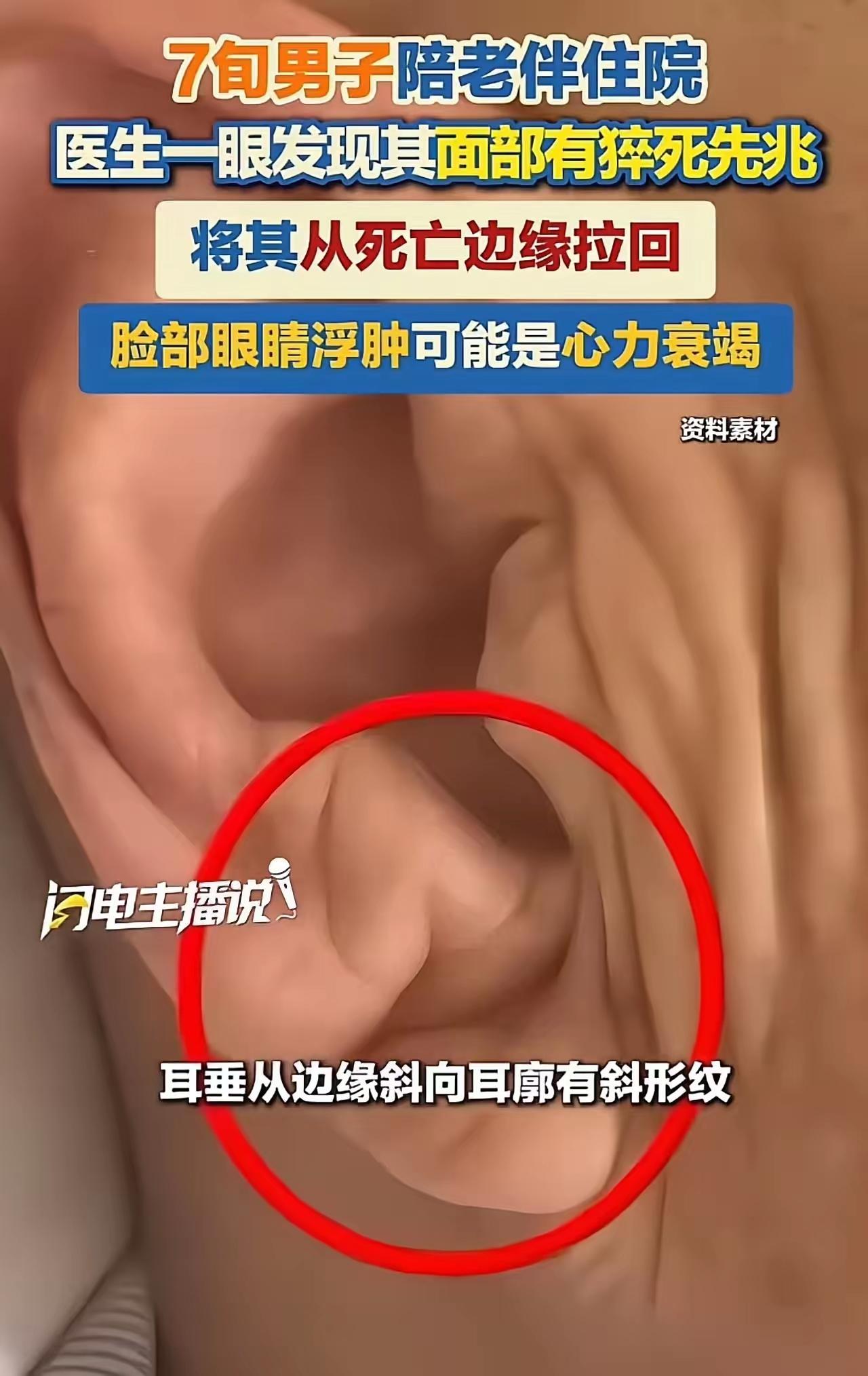 只因为多看了一眼，救了一条命！7 旬大爷陪床被医生“拦下”：你脸上写着猝死，血管