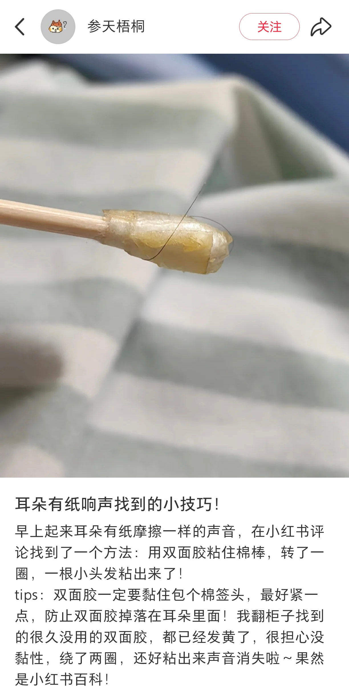 终于知道耳朵有纸响声怎么办了 