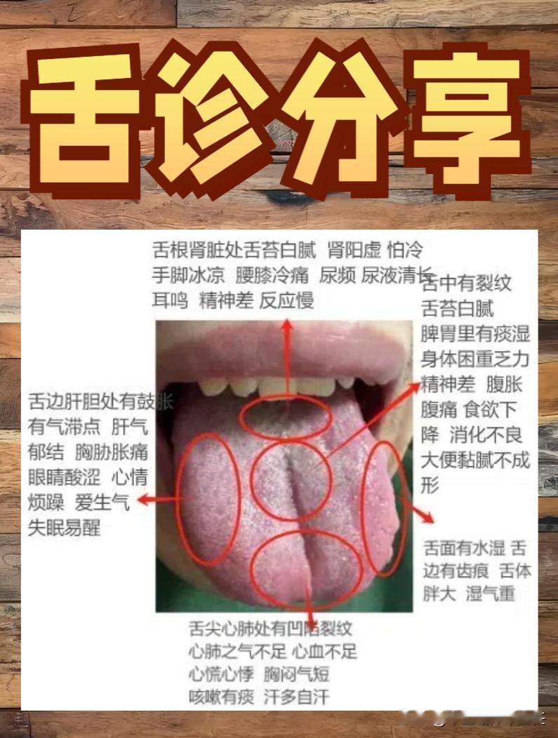 今天还是老样子，你发舌象，我来辨证！

给大家分享几个比较经典的舌象，很多人都会