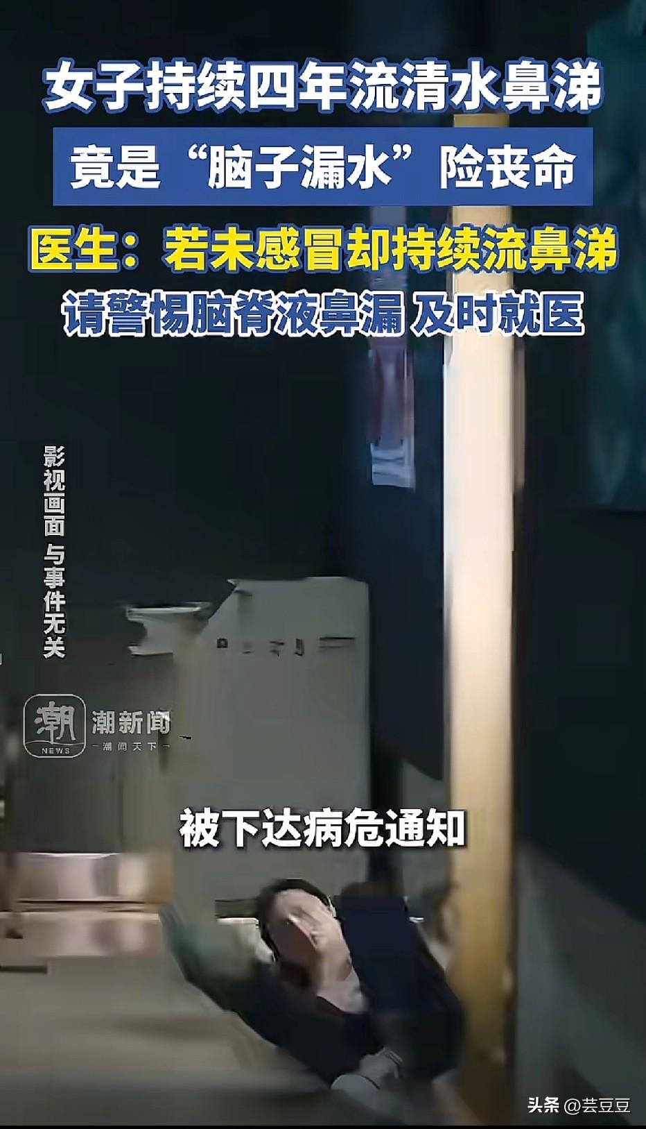 千万别当感冒！女子“脑子漏水”4年，差点没命！这种清水鼻涕千万警惕！
 
看完真