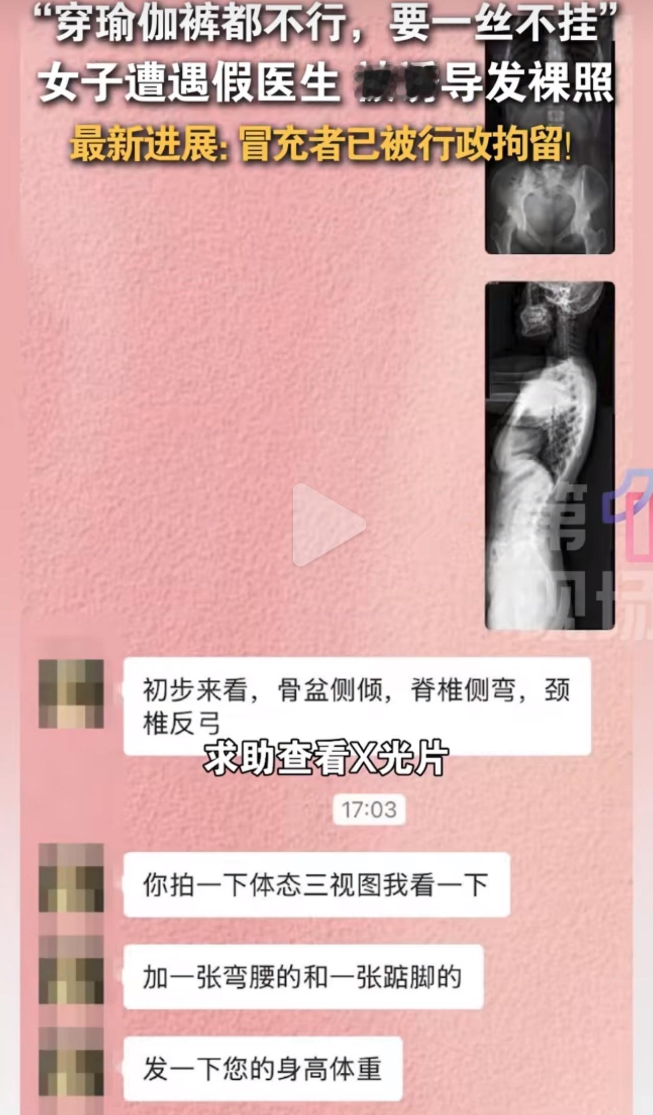 深圳一名女生在网上发帖，想找人帮忙看一看自己的脊柱X光片子。

没过多久就有账号