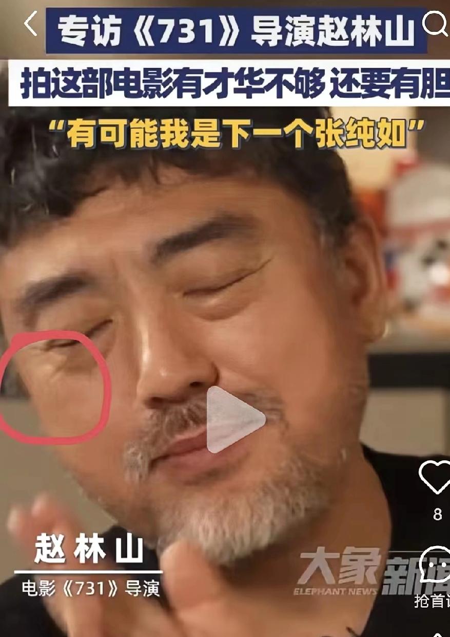 《731》导演赵林山说，
他有可能是下一个张纯如，
我却发现他的脸上有一个重大的