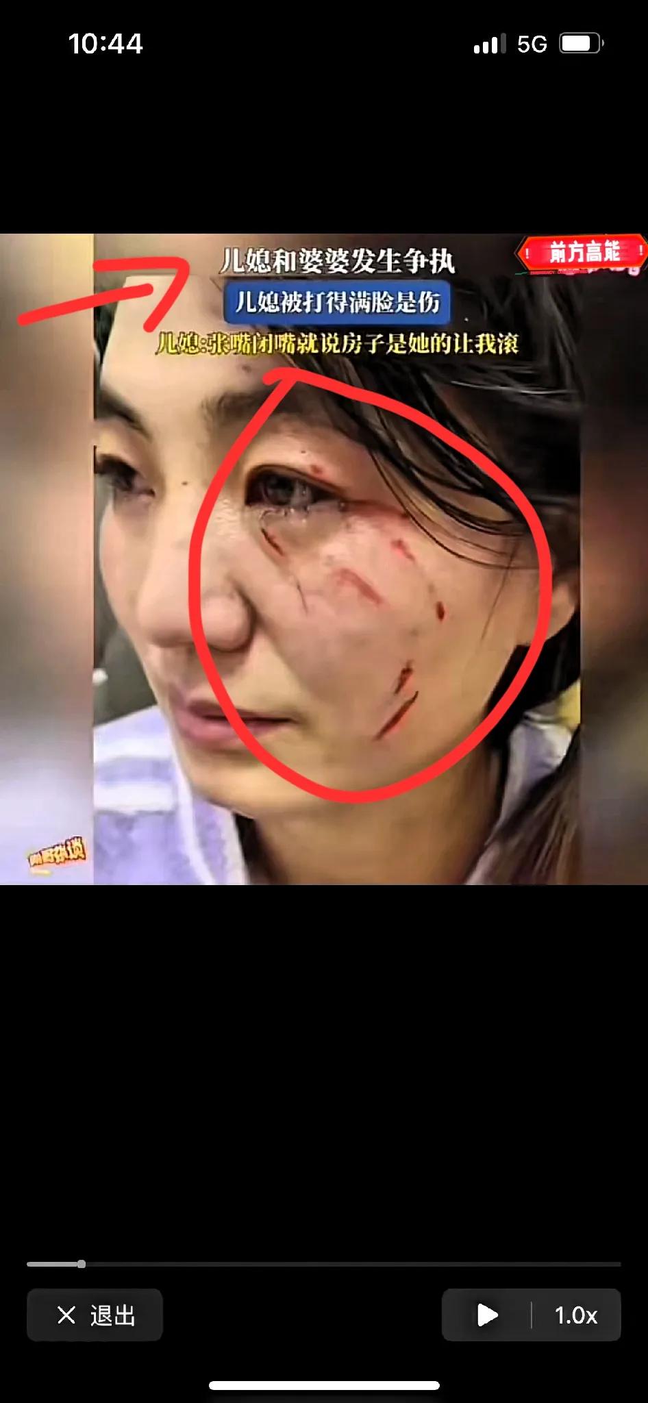 婆媳之间吵架很常见，但动手伤人，把儿媳赶走，这种情况还是比较少见的。
这不，网上