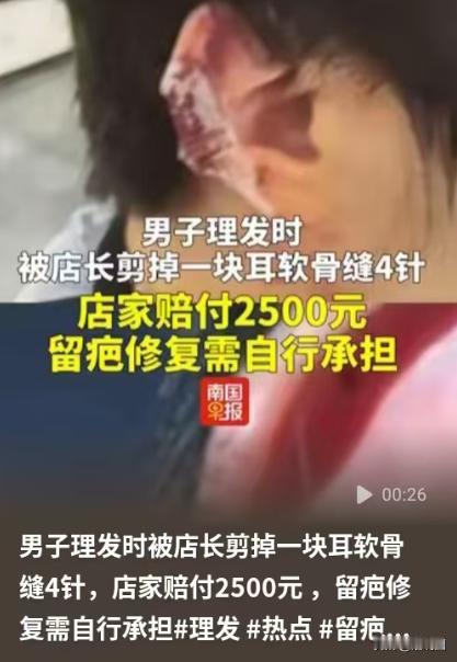 湖北黄冈，男子去剪头发，店长一个不小心，把他的一块耳软骨给剪了，他们拿创口贴止血