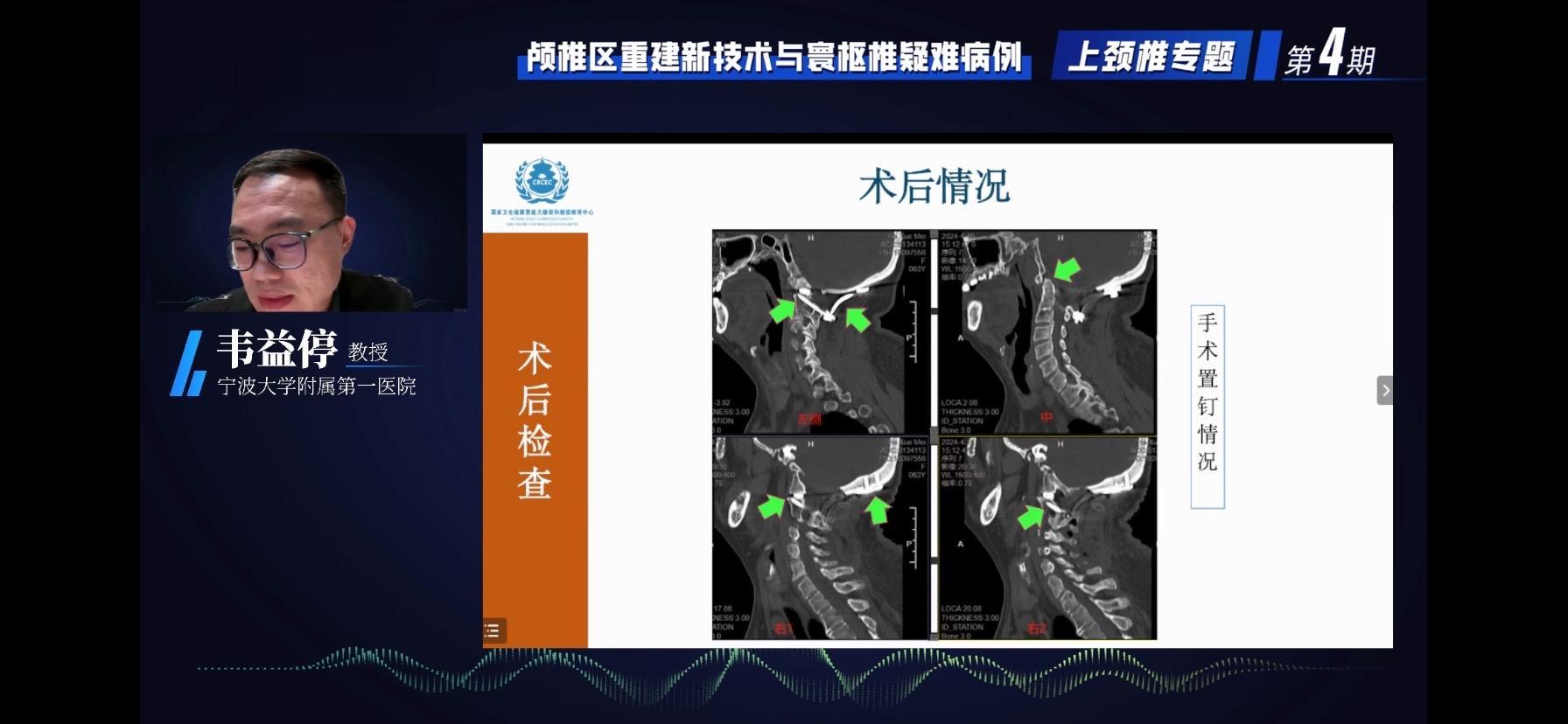 神经外科和脊柱外科面对面交流。环枕区病变结构复杂，功能重要，是医学的世...
