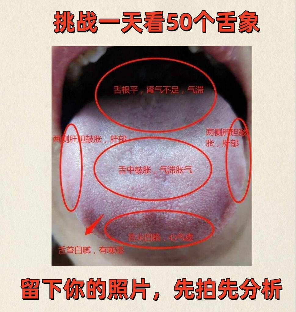 实战舌诊——看50个舌象

继续公益为大家看舌象，只要你发我就继续看！

你拍的