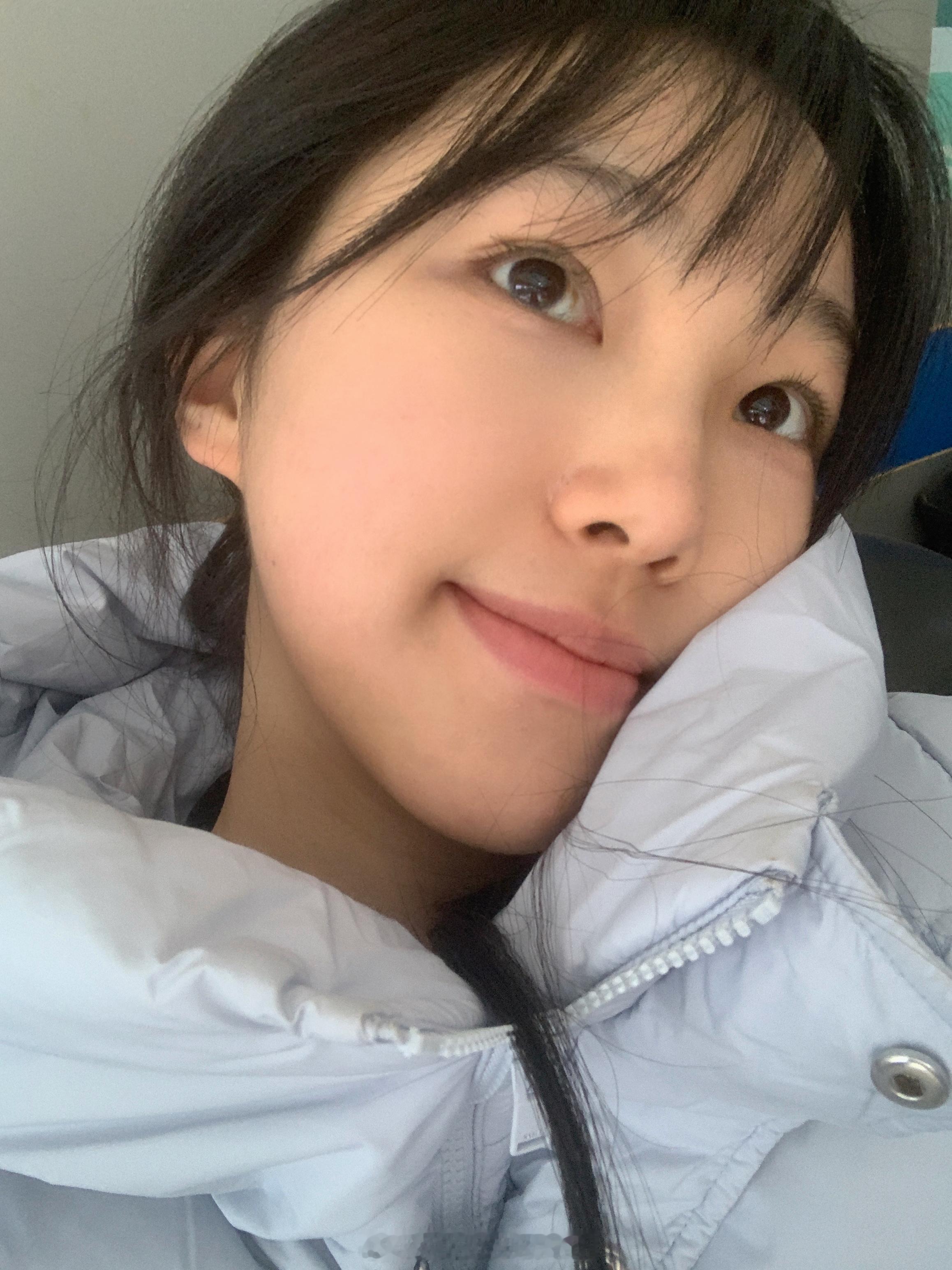拔智齿了🦷 预计明天将会肿成大猪头 ​​​