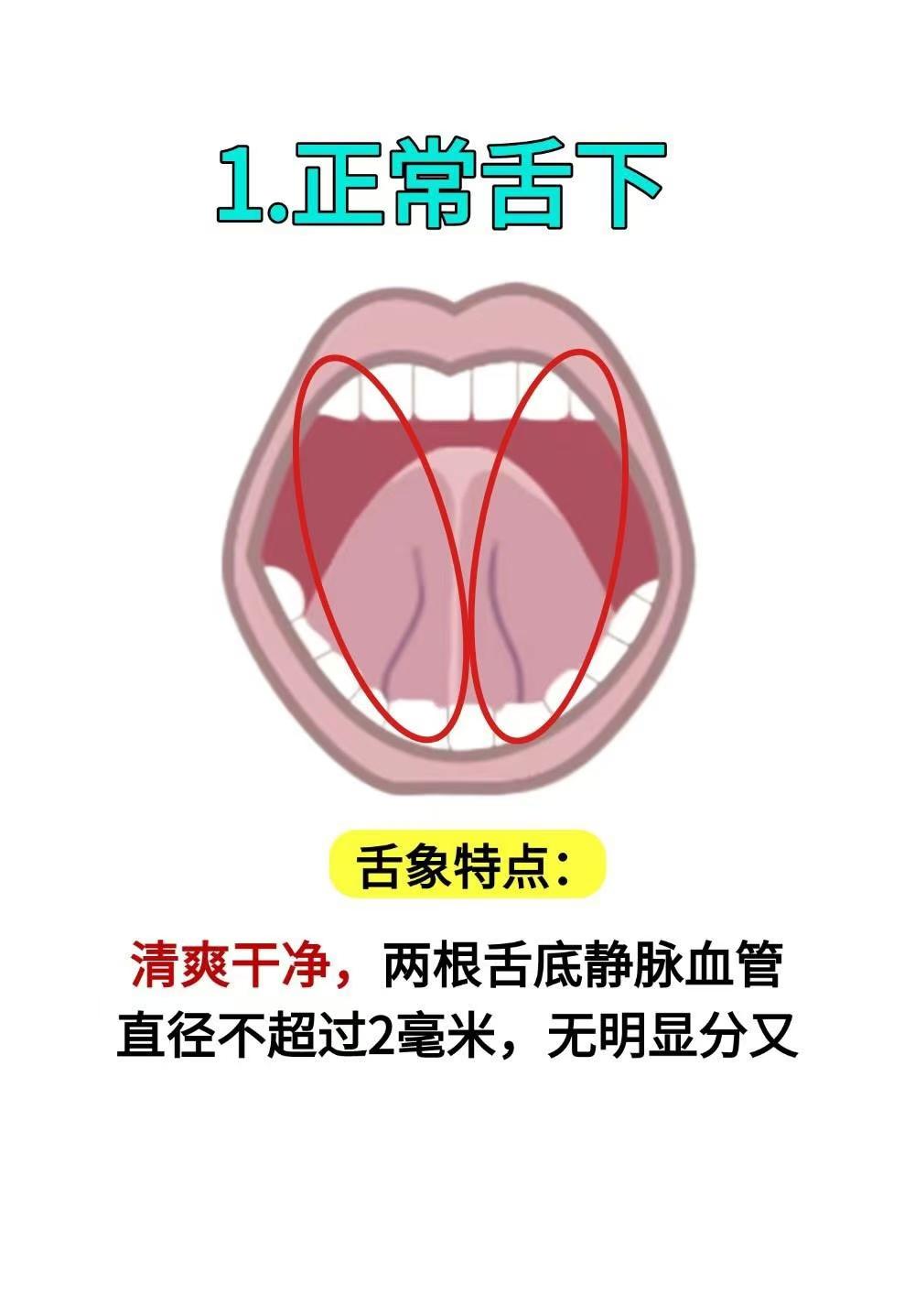 看舌底颜色，辨身体健康！
（注：本内容只做科普分享，不做任何营销推广，如有相关问