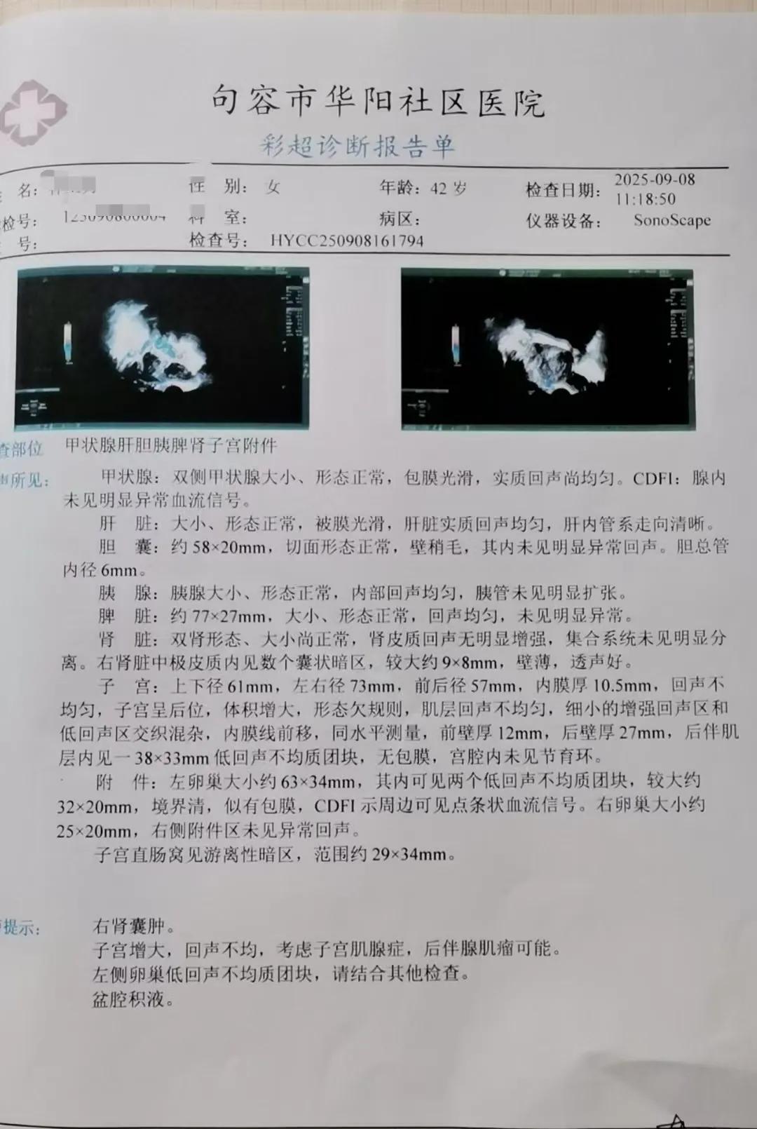 江苏省人民医院的陈医生真是太好了！跟踪服务十分到位，堪称患者的贴心人。
有一位子