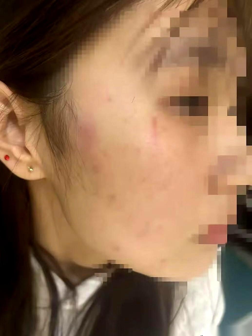 离谱，太离谱了。
一个18岁的姑娘，自己在家，被人闯进来按在地上打，最后的结果是