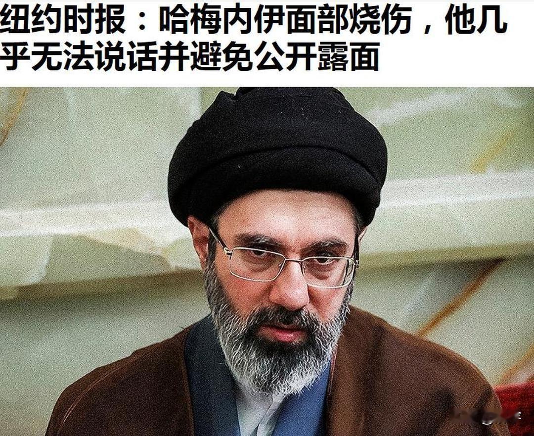 纽约时报：哈梅内伊面部烧伤几乎无法说话。

纽约时报有关伊朗现任最高领袖穆杰塔巴