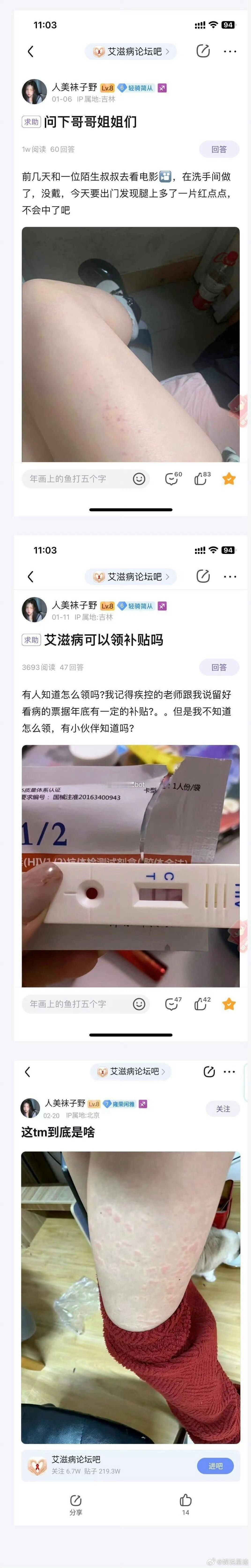 不可能发病这么快吧？ 