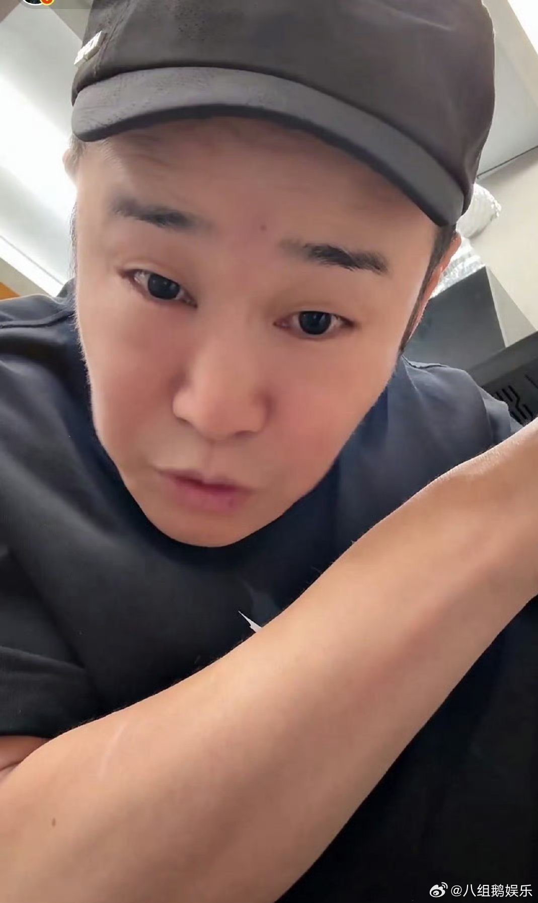小沈阳肿成蜜蜂小狗了公演前夕眼部浮肿，小沈阳选择主动和大家说明情况。直播里他现学