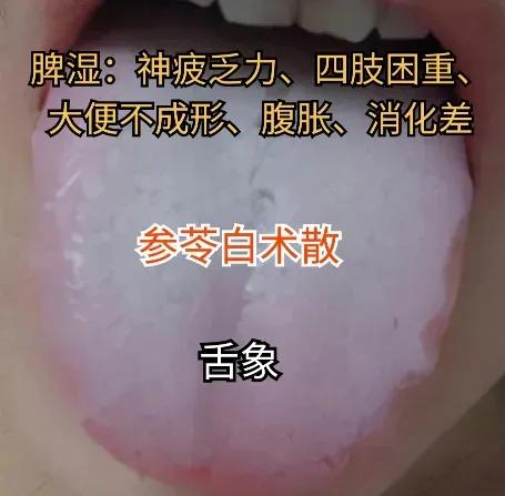 湿气，在中医理论中，被视为一种病理因素，常常与脾胃功能失调有关。湿气过重可能导致