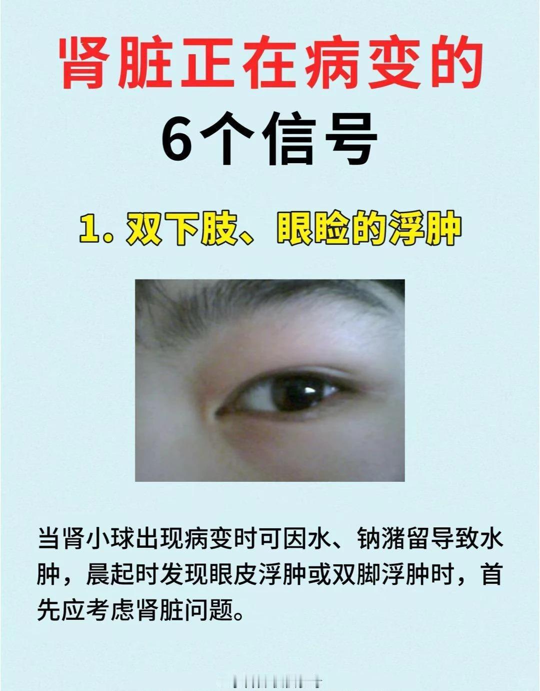 肾脏健康预警：这 6 个信号别忽视