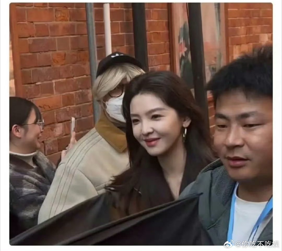 都说章若楠是很多人的白月光，这法令文更黑眼圈多少有点严重 