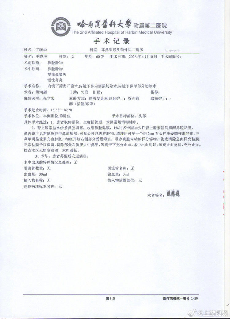 #术后引流管被遗留鼻腔14年女子发声#【女子称术后引流管被遗留鼻腔14年，院方回