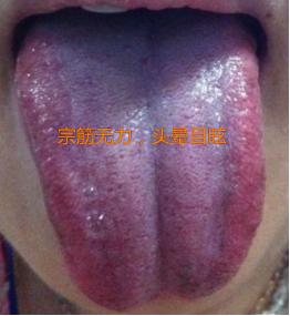 宗筋起立困难，中途易疲软，一方为你打通经络，从此更坚挺！
 
今天分享的这个方子