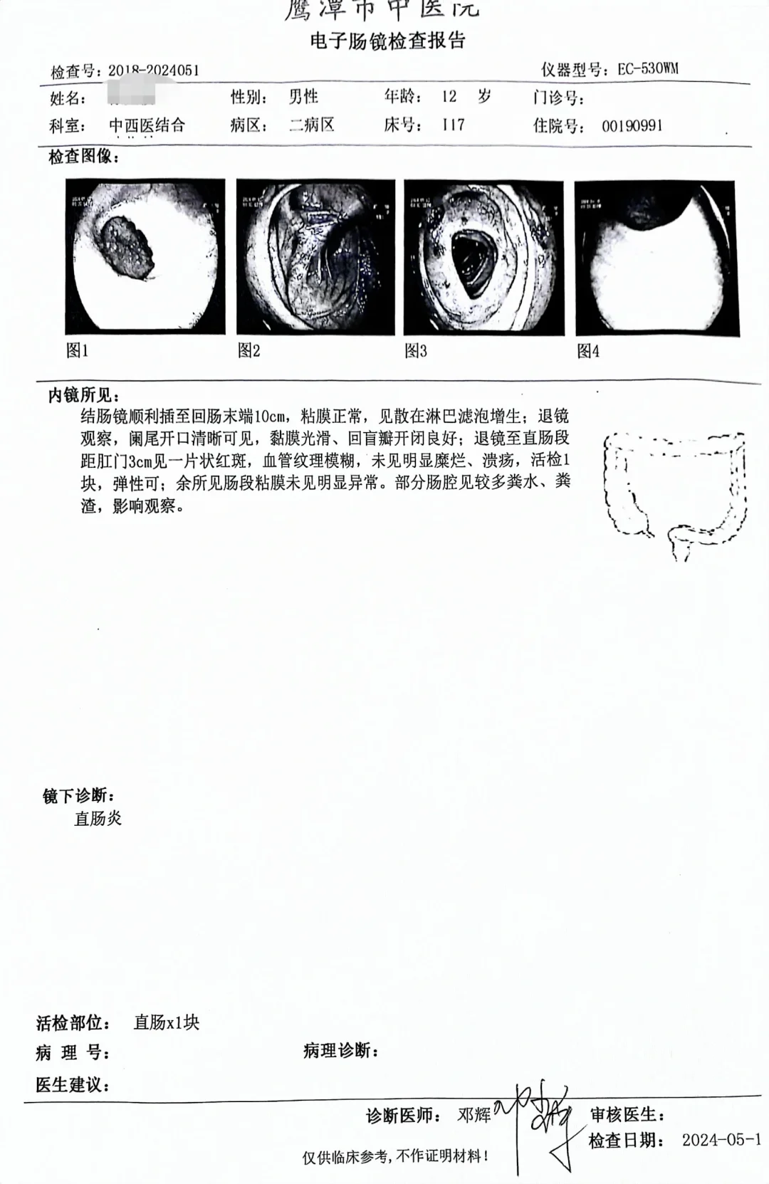 不是报告写着克罗恩病就是克罗恩病。