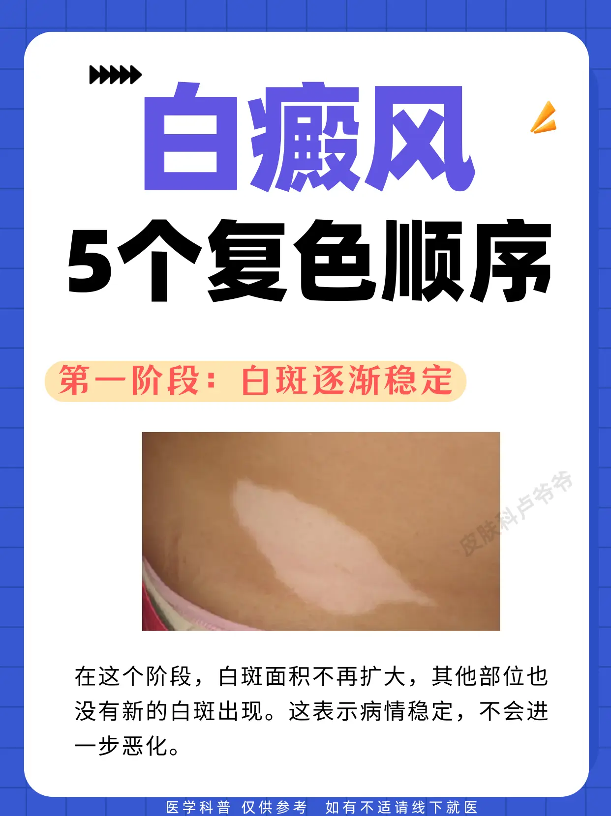 医学科普 白癜风 白癜风科普 白癜风患者 硬核健康科普行动