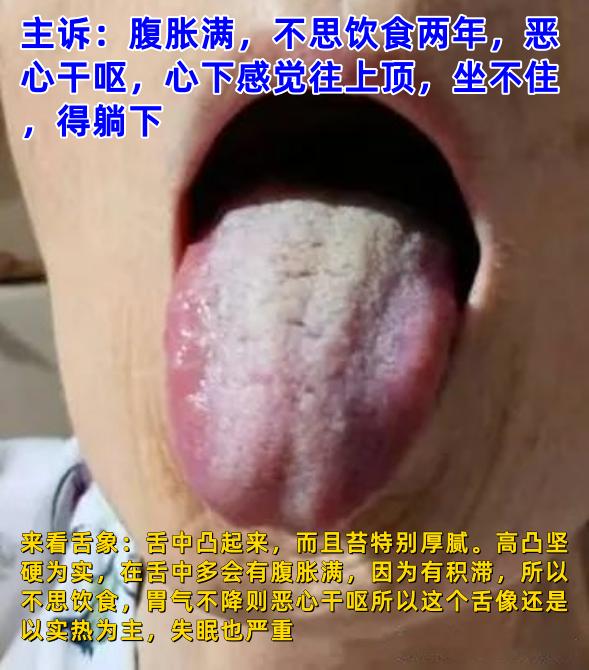 今天有时间，抽空给大家分析舌象：

注意：
1.拍照时，尽量整个舌面都露出来，且