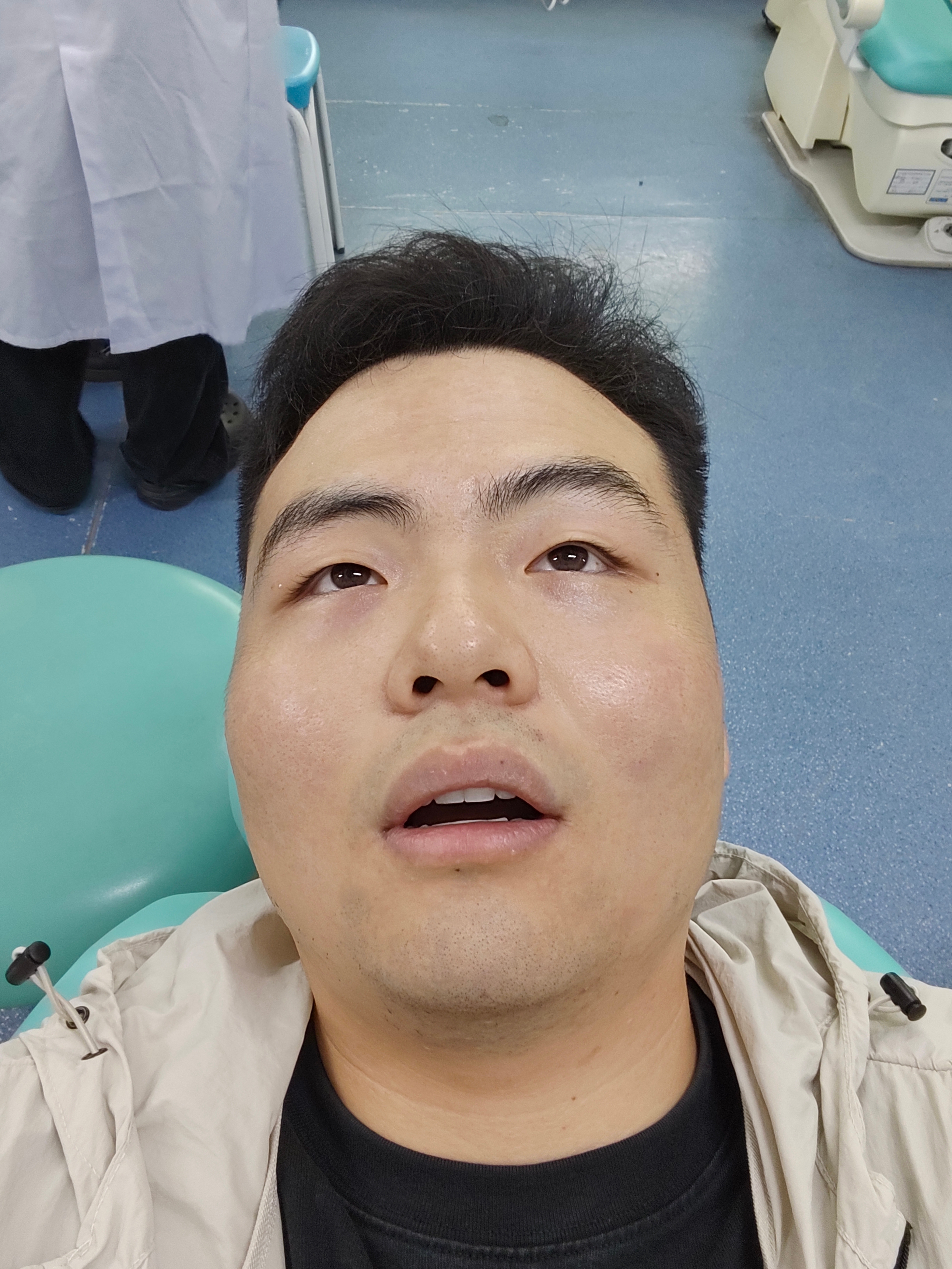 医生让我漱口，可是我已经感觉不到嘴了好想笑，但是笑不出来。 