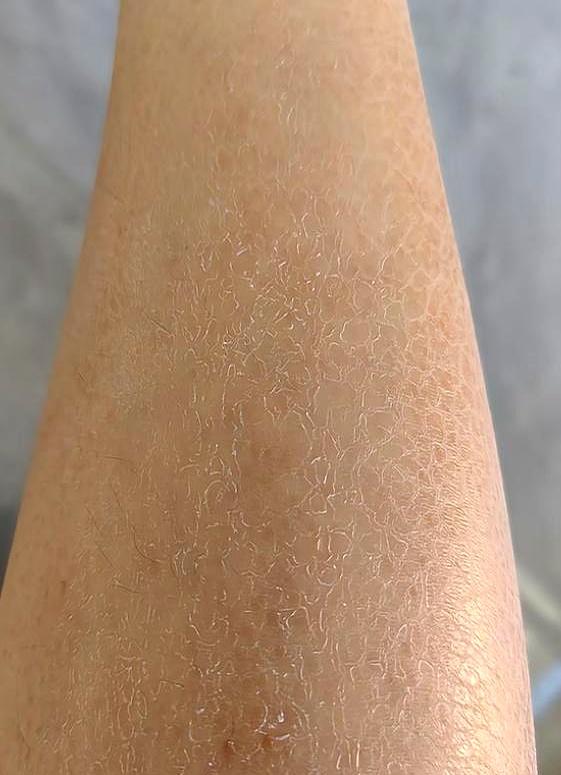 水龙头一关，腿上立马起白屑、干裂，润一抹，撑不过一会儿；从小就糙，摸着不顺手，不
