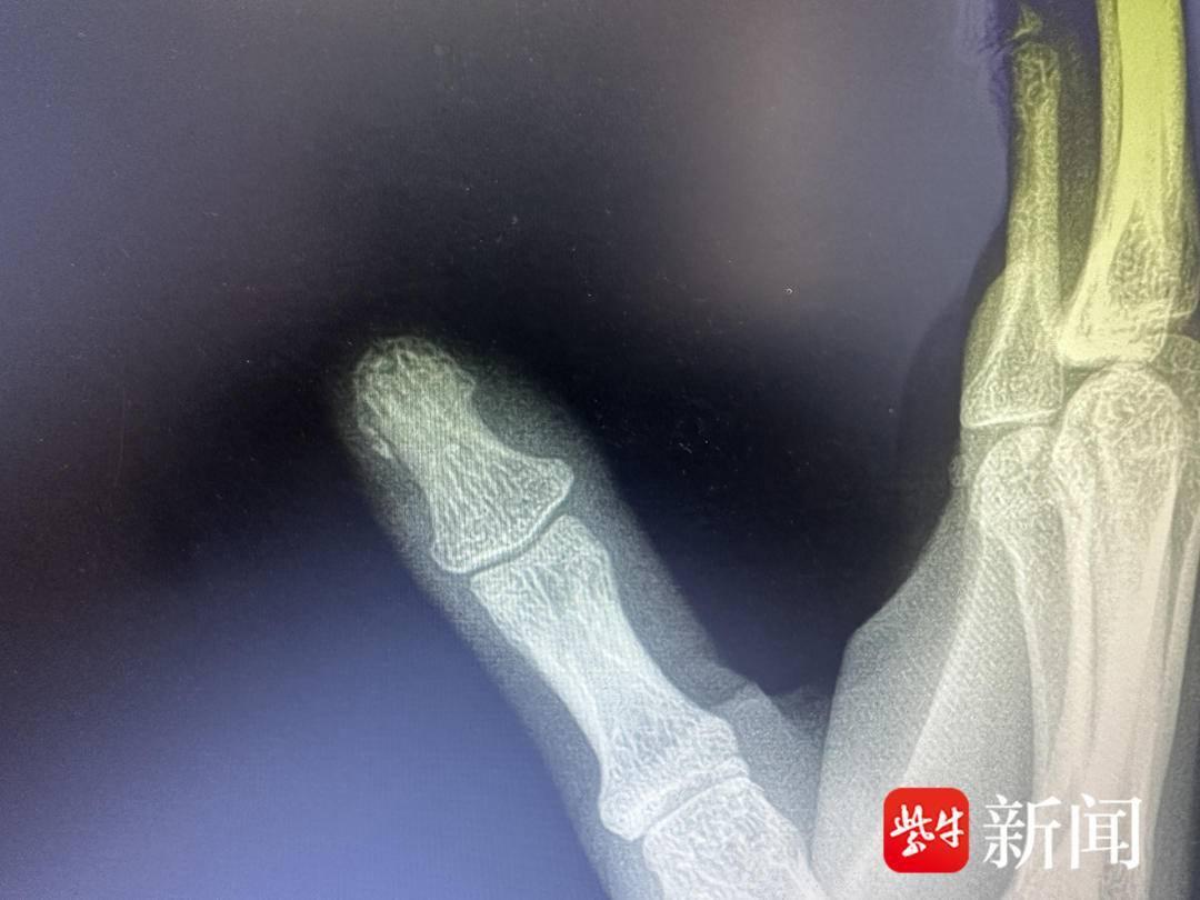 江苏苏州，一名小米SU7车主遭遇糟心意外，车主购车仅两个月，怎么也没想到，就一次